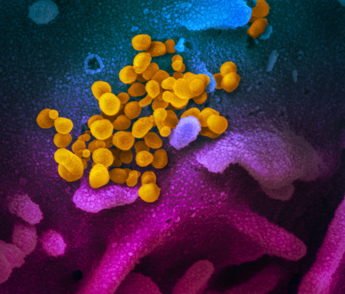 Coronavirus, due sostanze nel sangue ne predicono l’evoluzione
