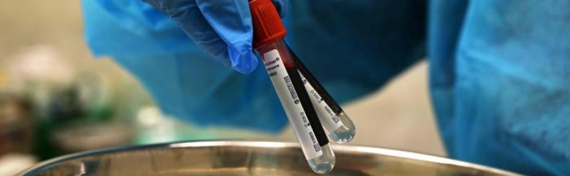 Coronavirus: stabile crescita positivi in Calabria, +10