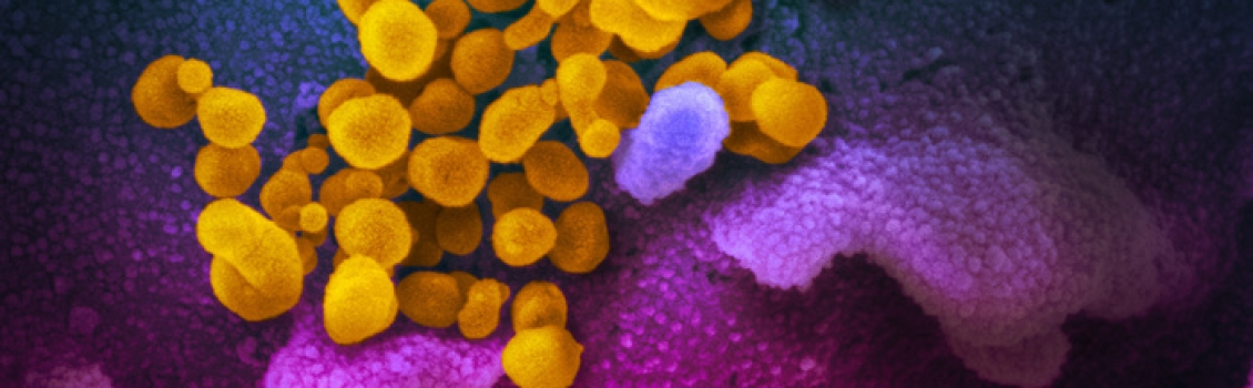Malware sfrutta pandemia per chiedere soldi