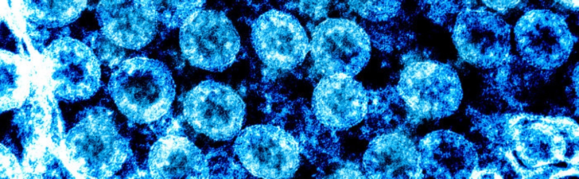 Coronavirus, ok ai test preclinici per un vaccino italiano